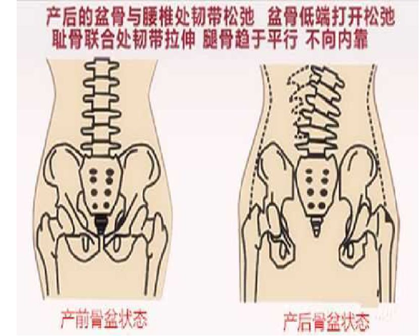 高级产后恢复师课程之骨盆恢复